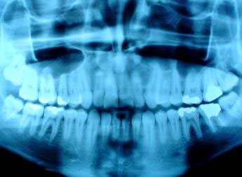 dental x-rays