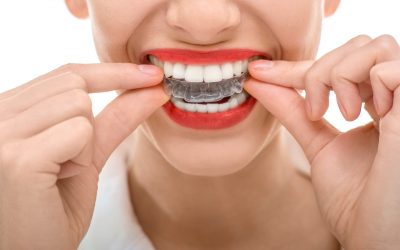 Tips to Make Invisalign Unchallenging