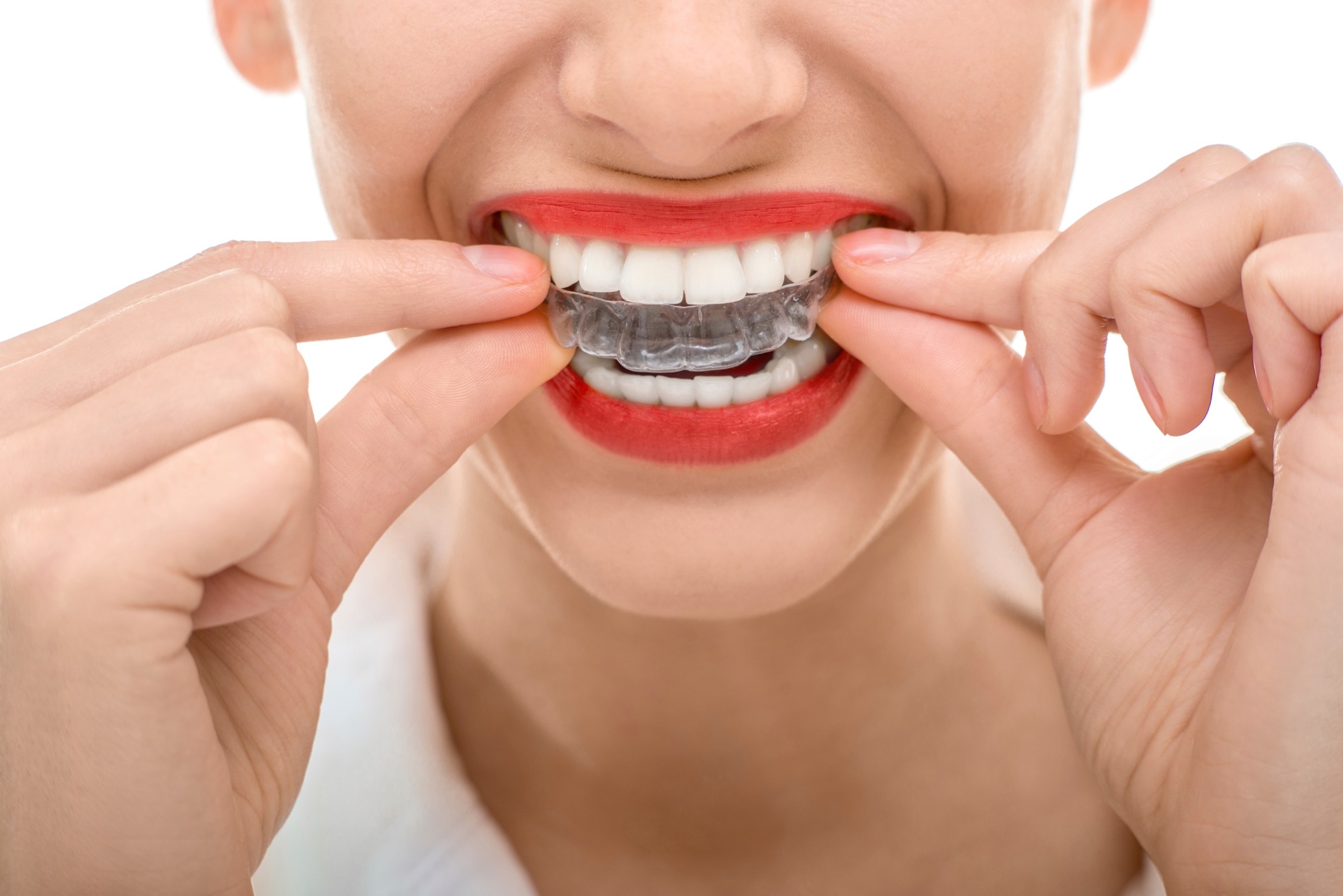 tips-to-make-Invisalign-unchallenging